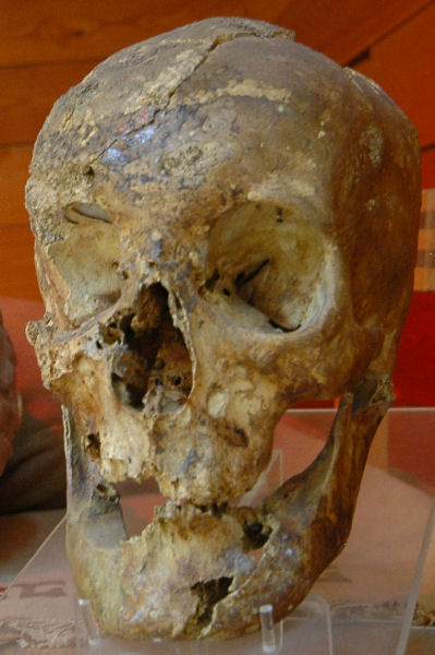 Gordium, Great Tumulus, Skull of the deceased
