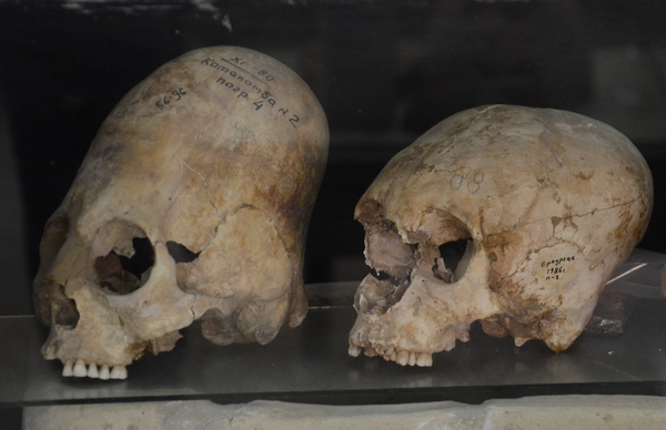 Afrosiab, Deformed skulls