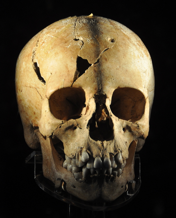 Athens, Kerameikos, Skull of Myrthis